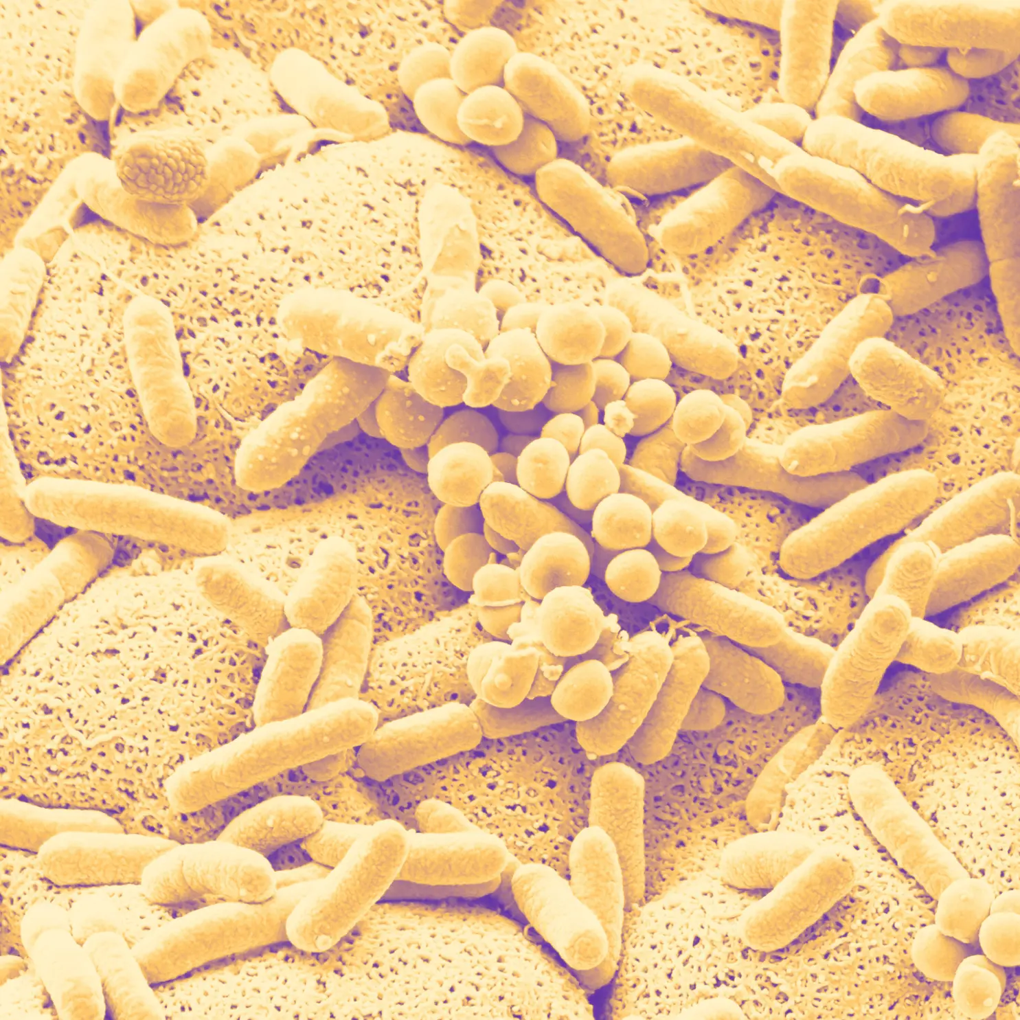 Duotone scanning electron micrograph of skin microbiota