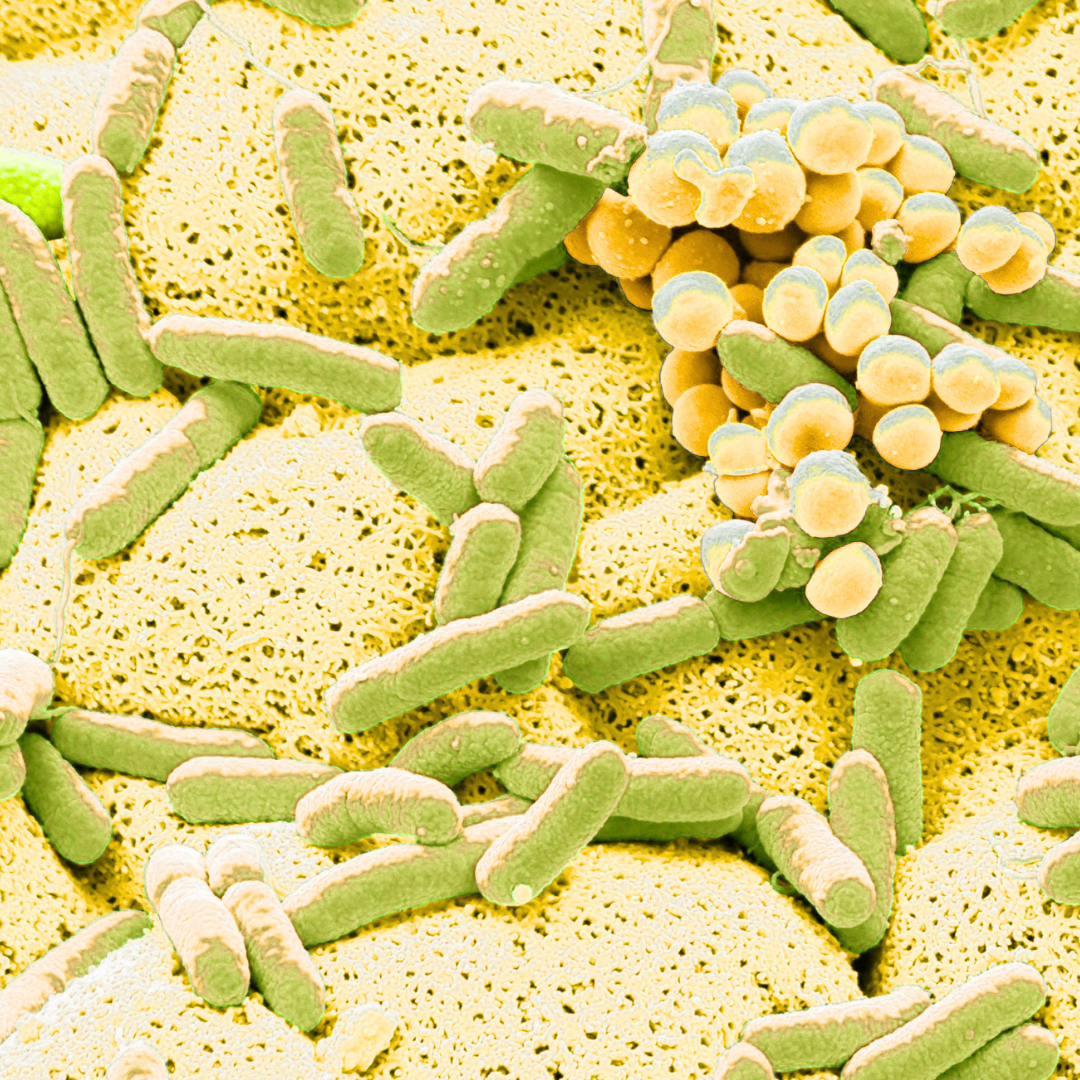 Electron micrograph of bacteria and yeast on a surface