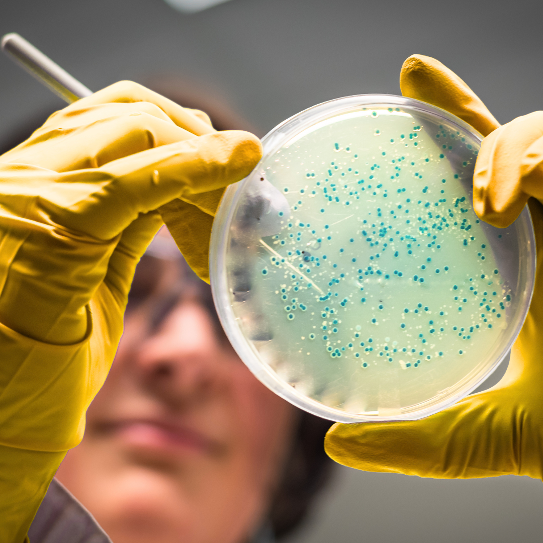 Scientist inspecting a culture plate in the lab